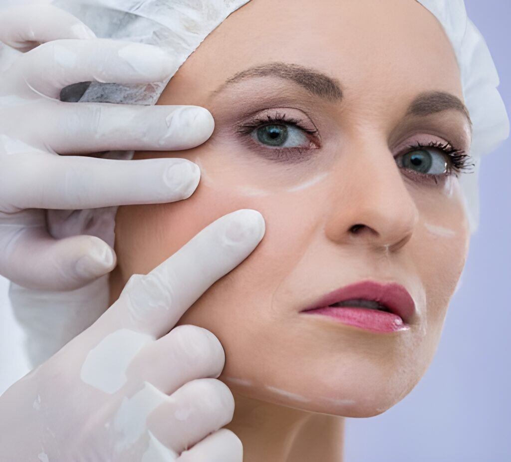 Smiling female patient post-surgery with clear skin and facial symmetry