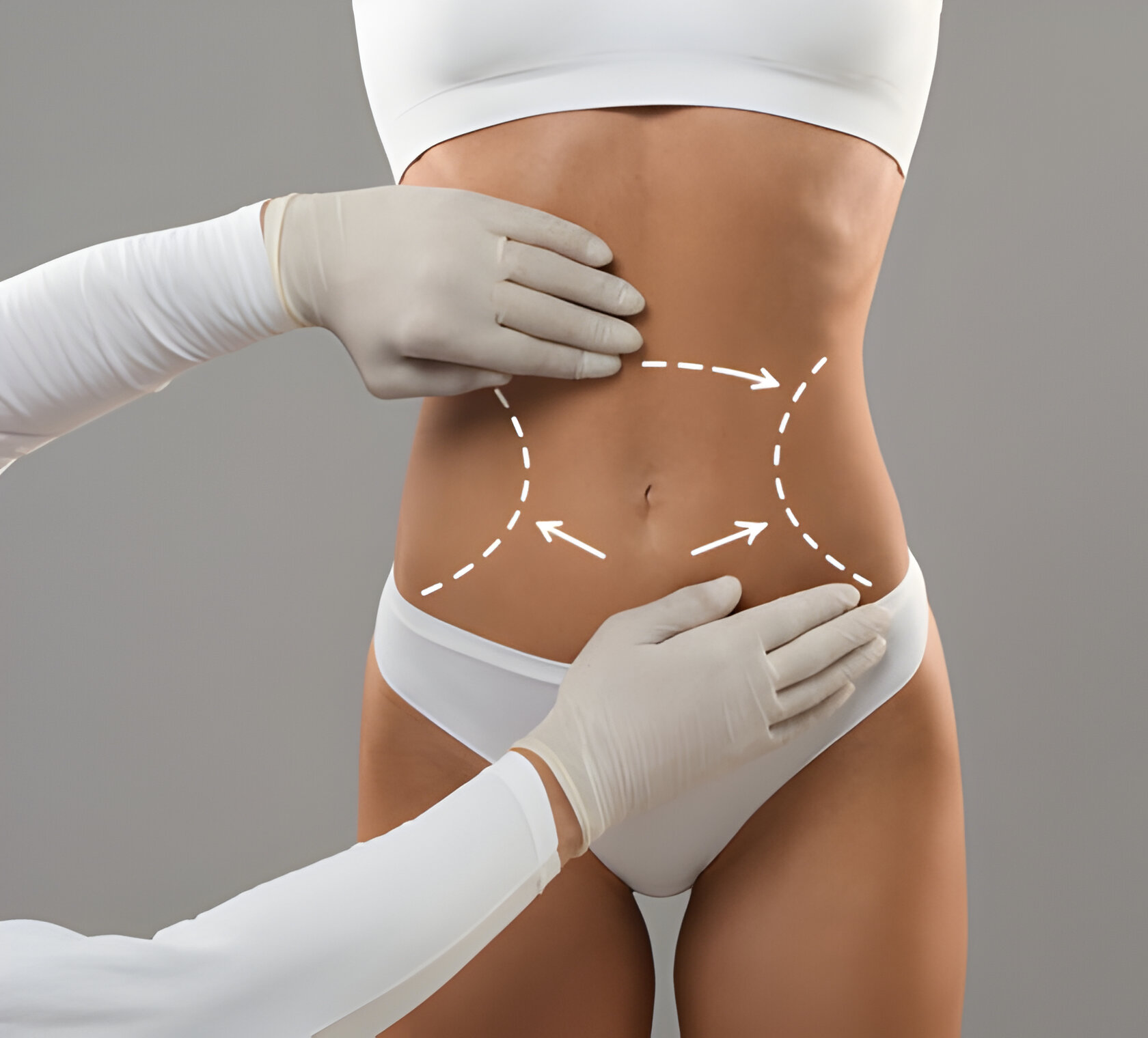 Body Contouring
